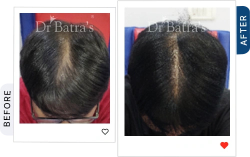 06 Before After