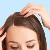 Female Pattern Baldness Treatment Results