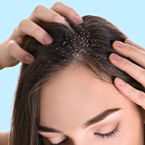 Dandruff Treatment