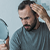 Male Pattern Baldness Treatment icon