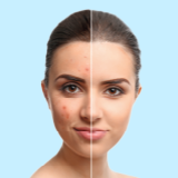 Skin Brightening icon