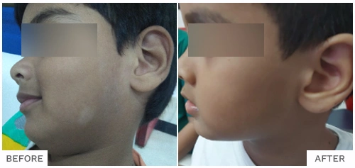 Hair Loss Treatment