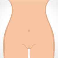 Symptoms of Oral Lichen Planus