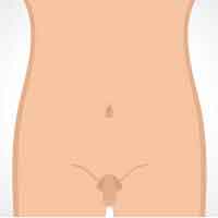 Symptoms of Lichen Planus On Lips