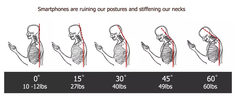 Effects of Overuse of Smartphones on our Neck