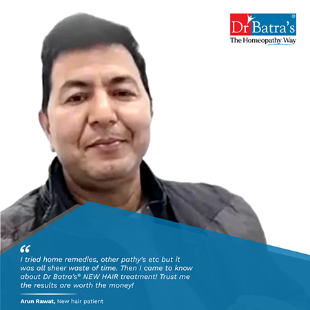 Best Homeopathic Hair Fall Treatment & Medicine for Men and Women - Dr Batra's® Best Homeopathic Hair Fall Treatment & Medicine for Men and Women - Dr Batra's®