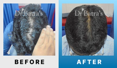 01 Before After