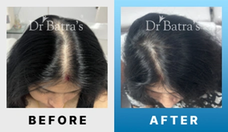 02 Before After