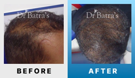03 Before After