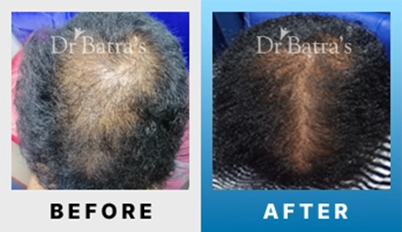 04 Before After