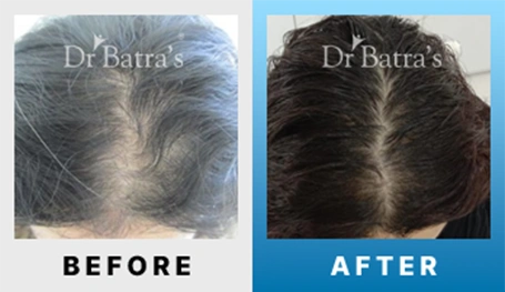 05 Before After