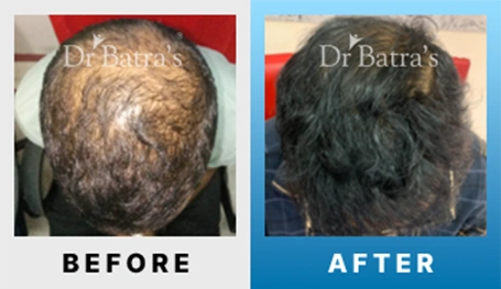 06 Before After