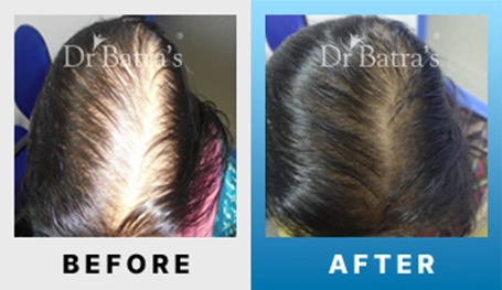 07 Before After