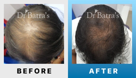 08 Before After
