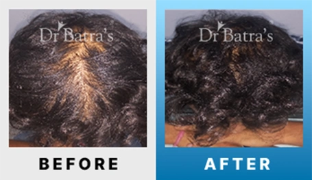 09 Before After