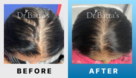 10 Before After