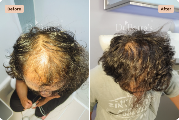 Hair Before After-1