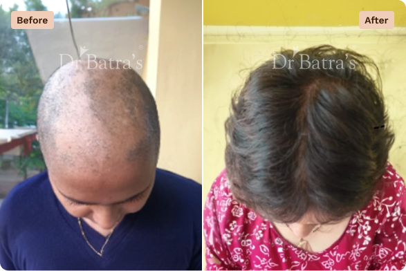 Hair Before After-2