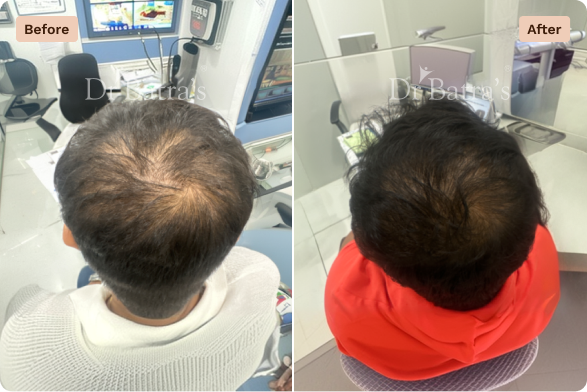 Hair Before After-3