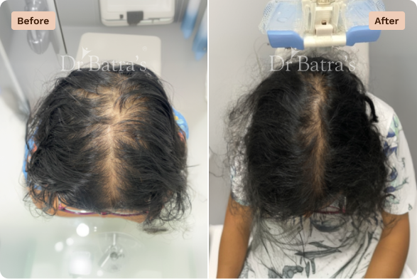 Hair Before After-4