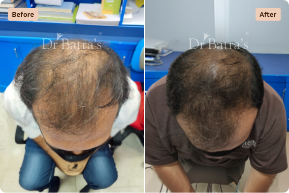 Hair Before After-5