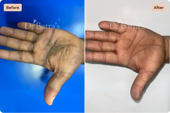 Skin Before After-1