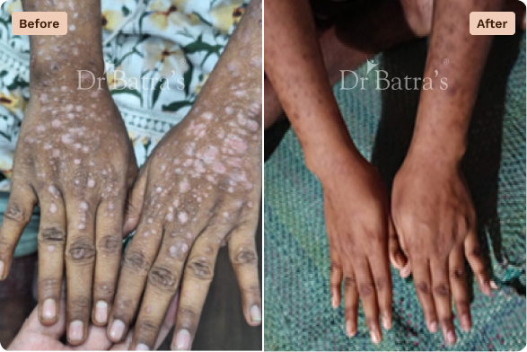 Skin Before After-2