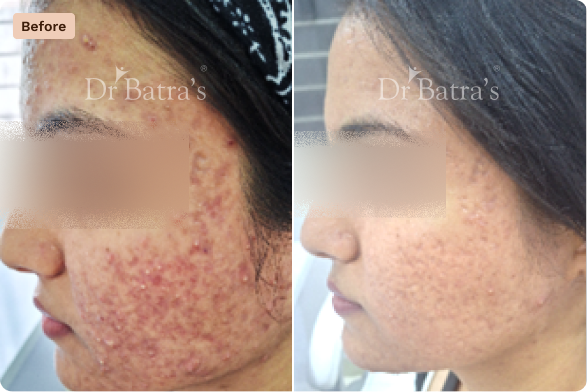 Skin Before After-5