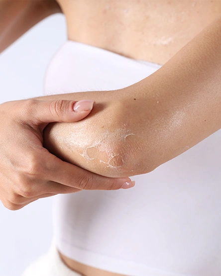 Homeopathic Medicines