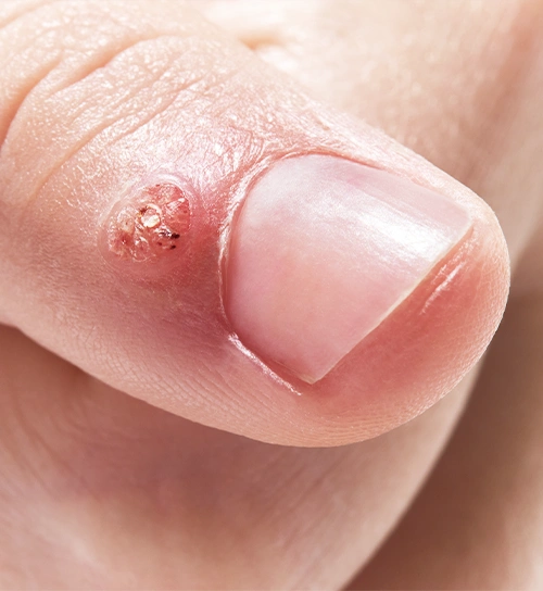 Homeopathy Images