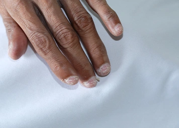 Fatigue or reduced physical activity