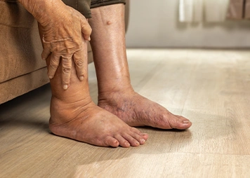 Shortness of breath during activity