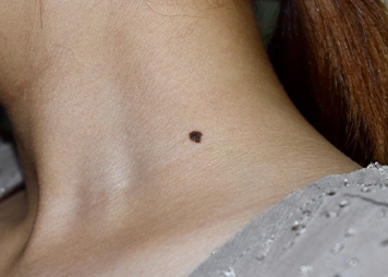 Having low self-confidence or withdrawing from social situations