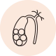 Gallstones