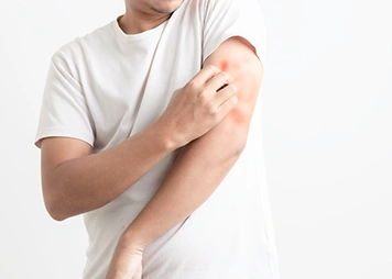 Itching or swelling of the lips, tongue, or face