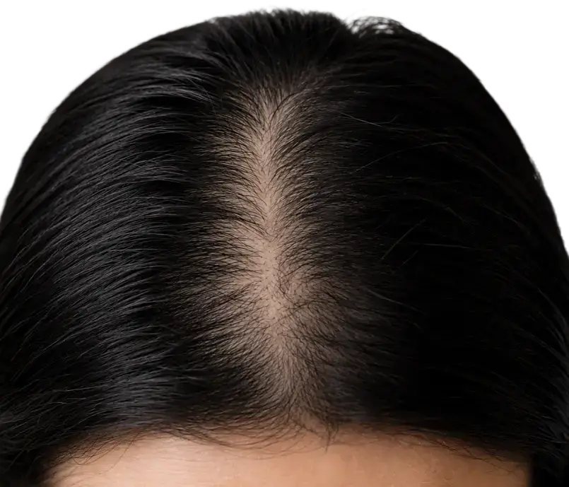 Hair Model