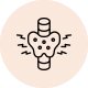 Thyroid nodules- Overactive nodules