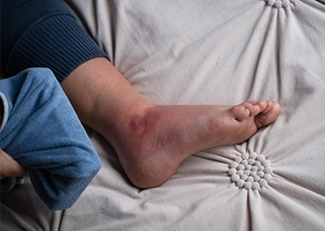 Shortness of breath during activity