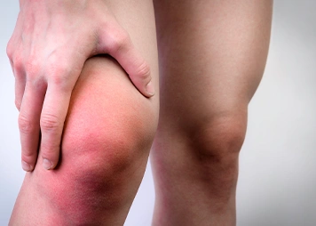 Swelling or inflammation around the knee