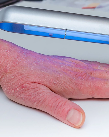 Homeopathic Medicines