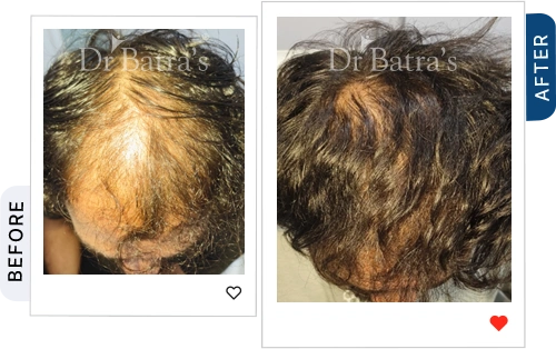 01 Before After