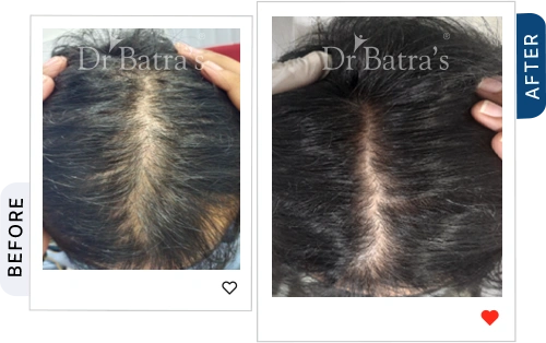 02 Before After
