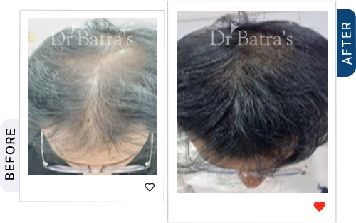 03 Before After