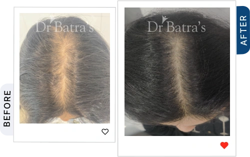 04 Before After