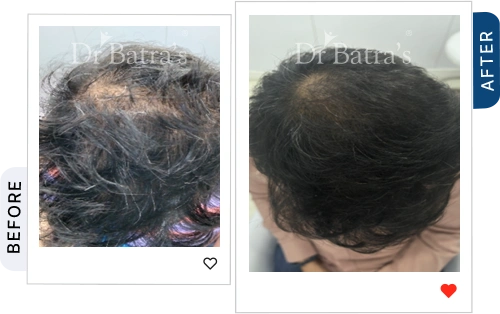 05 Before After