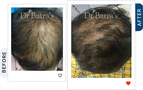 06 Before After