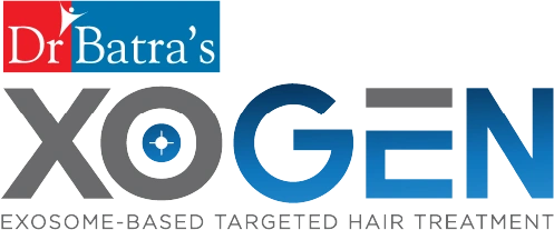 Xogen Advance Logo